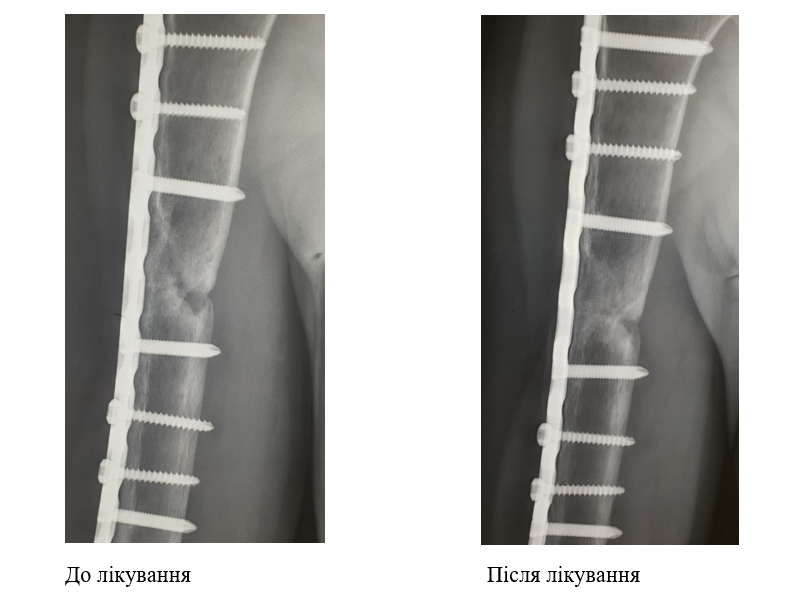 псевдоартроз